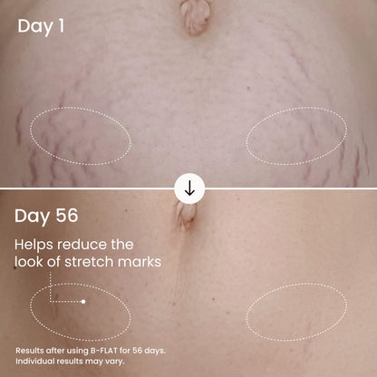 Soltra B-Flat Firming Belly Cream