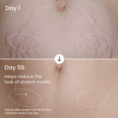 Soltra B-Flat Firming Belly Cream