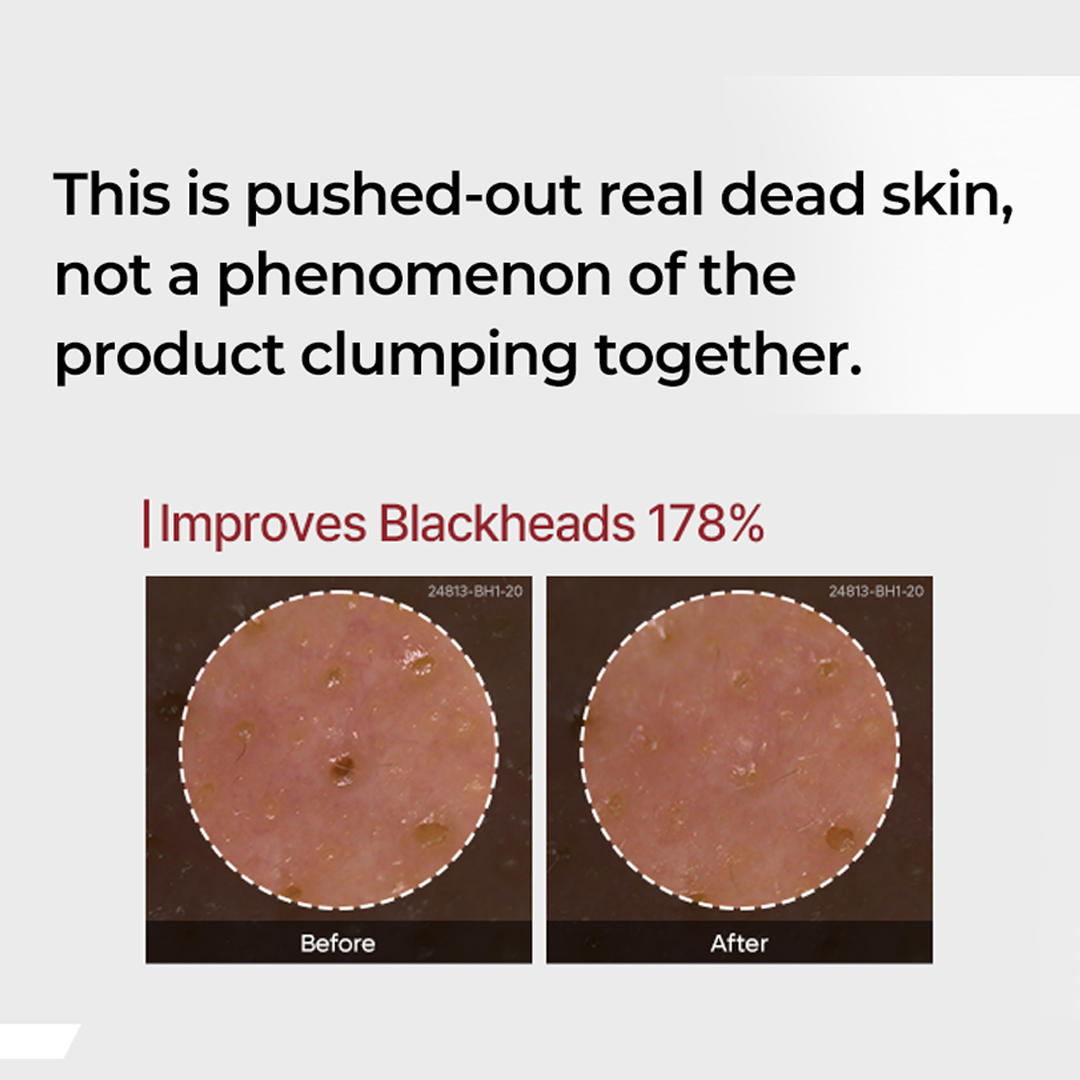 Dr.Melaxin - Peel Shot DUO