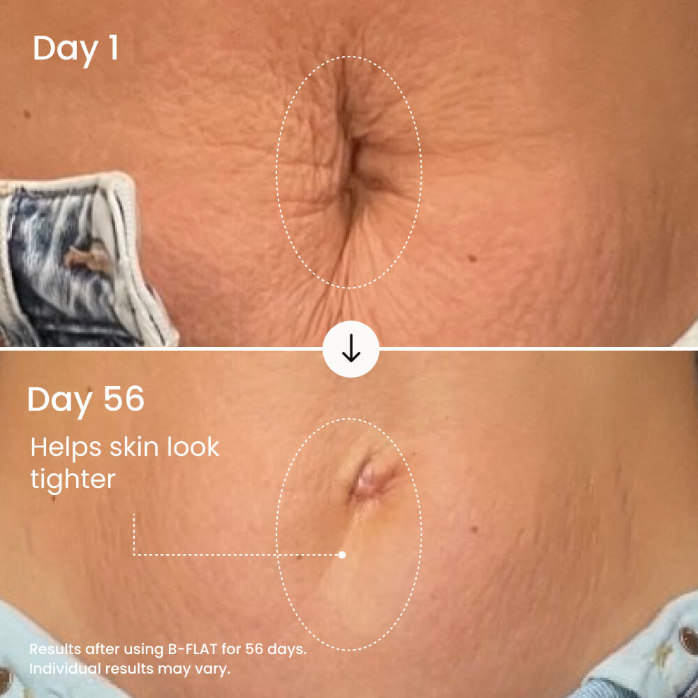 Soltra B-Flat Firming Belly Cream