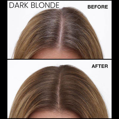 Never Miss Root & Scalp Spray